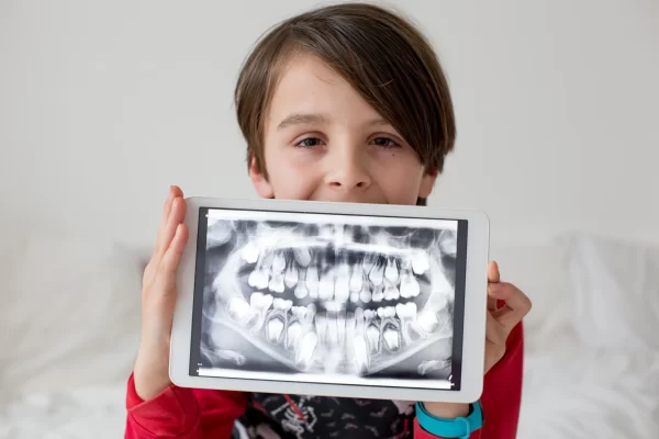 Child holding dental X-ray on tablet