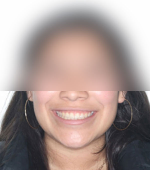 Person smiling wearing hoop earrings