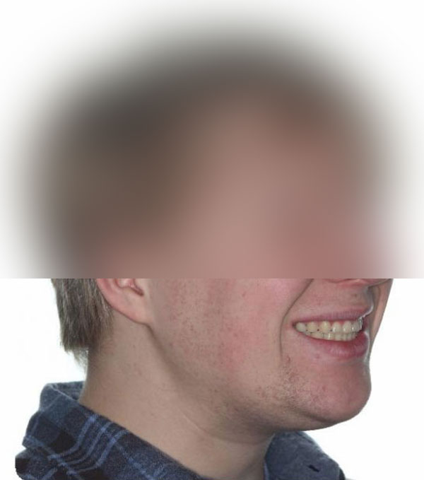 Smiling person with pixelated face