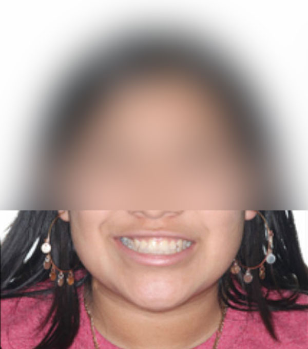 Smiling person with decorative earrings and necklace.